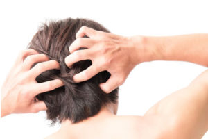 men-scalp-smell